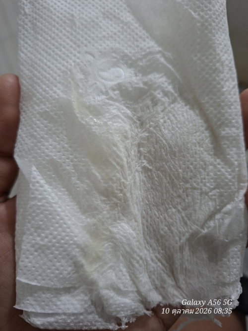 แบบนี้เรียกว่าอะไรคะ มูกไหม