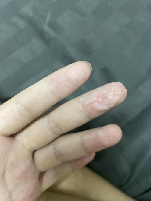ท้องแรก38วีค