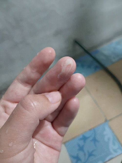 35+4วีคค่ะ