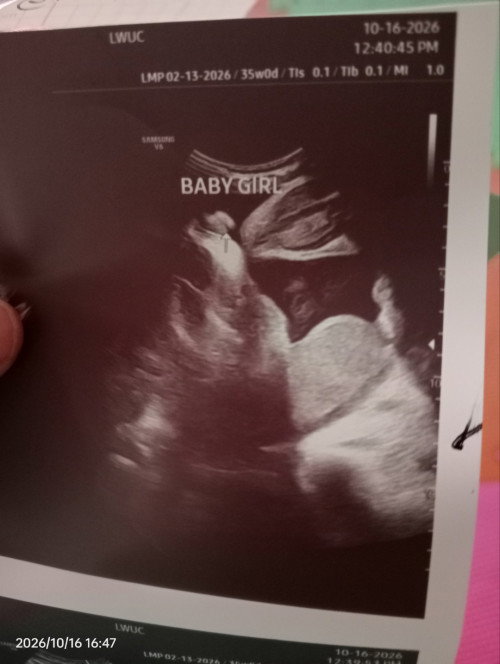 Baby girl po ba talaga sya ?