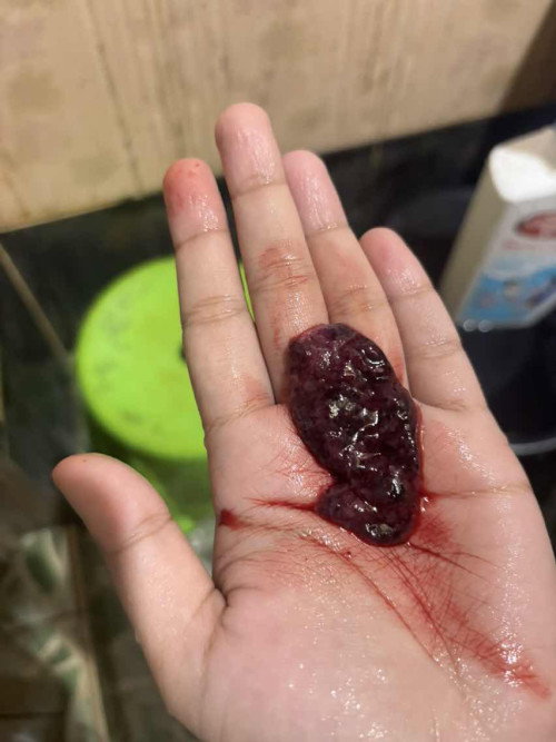ini kantung ke