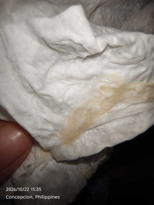 Is this mucus okay for 22 weeks pregnant?