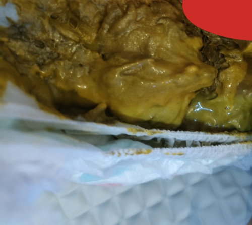 ALERGI SUSU SAPI?