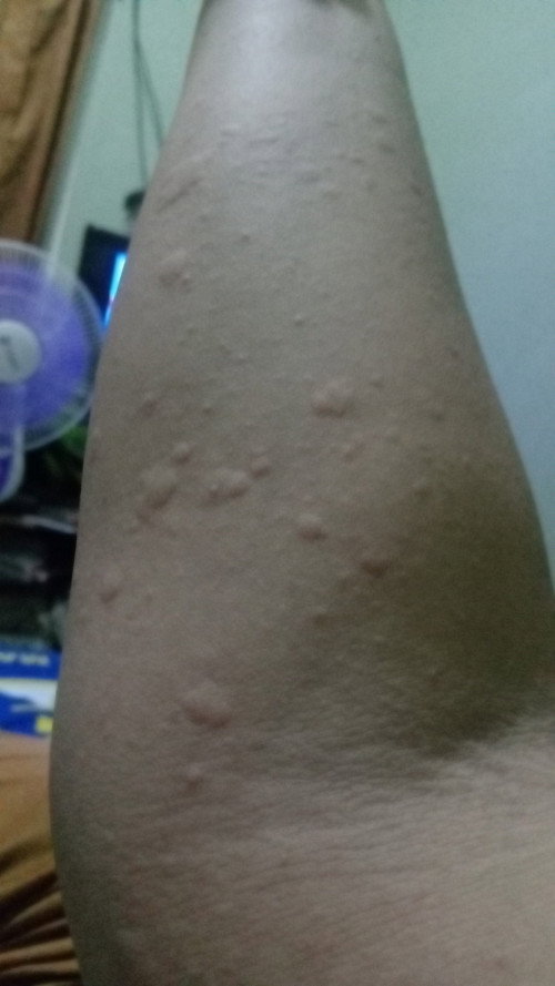 Obat/sabun