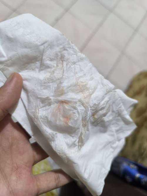 Keluar lendir campur darah tapi belum kontraksi