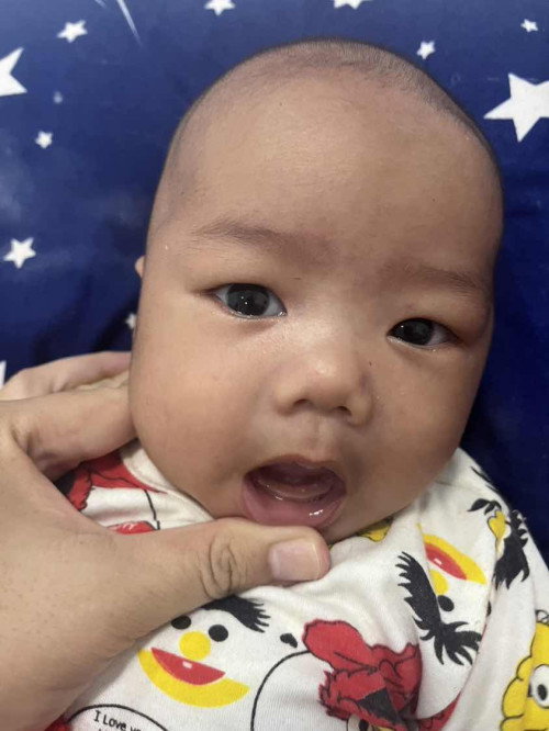 ใช่ฟันน่องหรือไม่