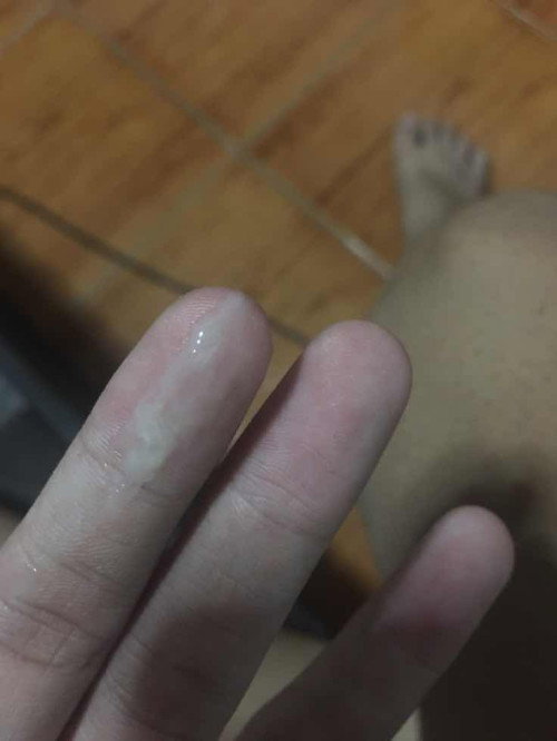 มีแบบนี้ออกมาจากช่องคลอด