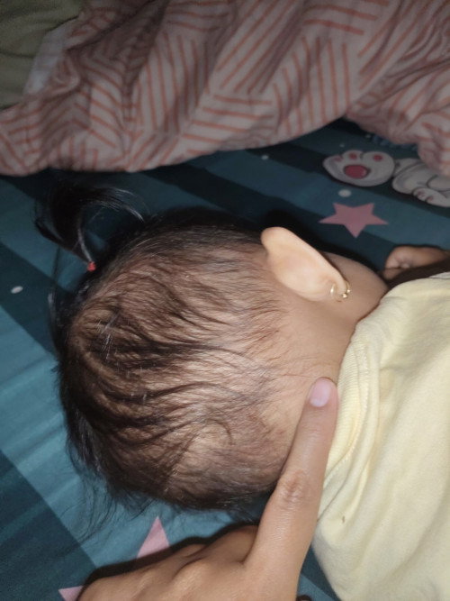 benjolan belakang leher anak