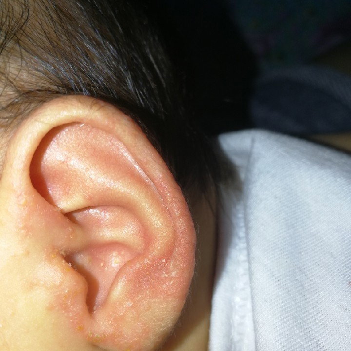 Ears