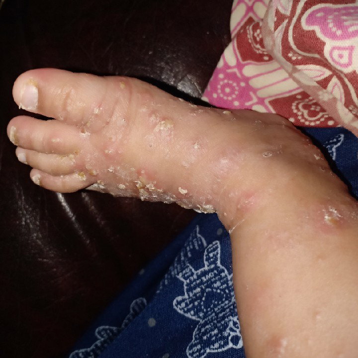 kaki baby umur 2bulan