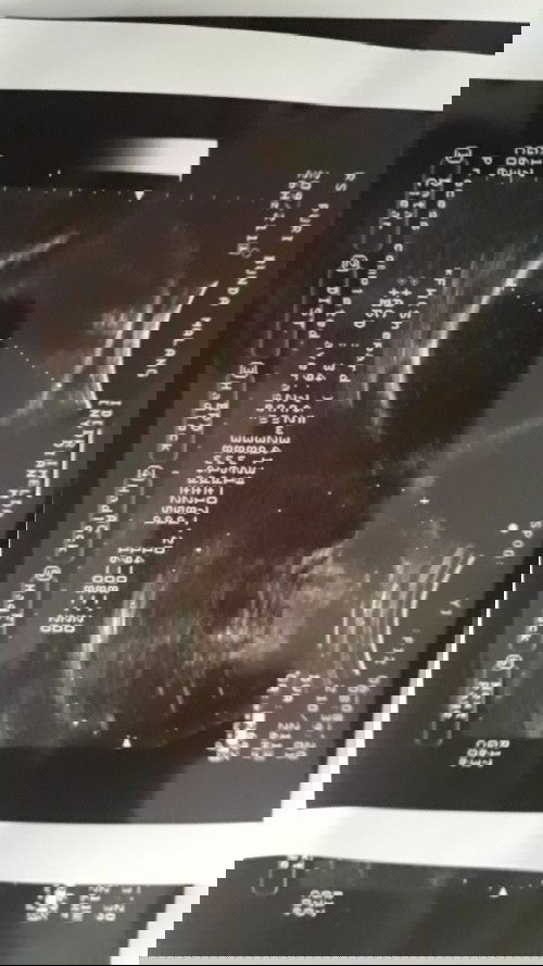 pijat akupresur untuk merangsang kontraksi