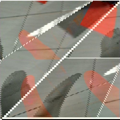 Dermatitis /Alergi Detergen = Penyakit Kutukan?