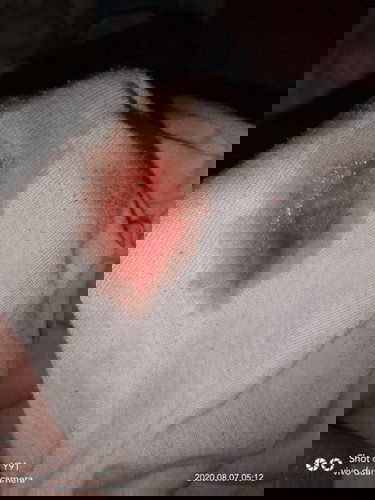 implantation bleeding or period π«π₯