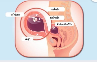 ขอคำเเนะนำวิธีจัดการอารมณ์นอยๆตอนตั้งครรภ์