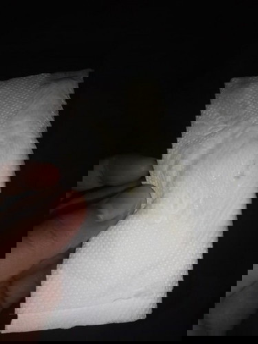 is it normal?