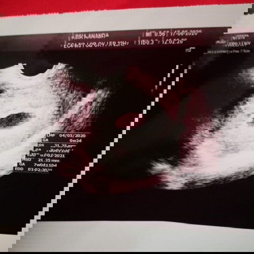 Usia Kehamilan 6w masih kantong