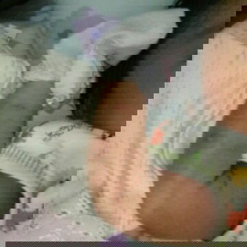 ini sawan atau alergi ya bun ?