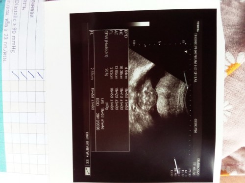 ดูออกไหมคะ