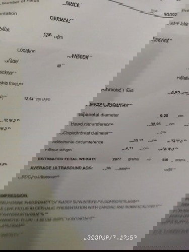 normal po ba result ng ultrasound ko?