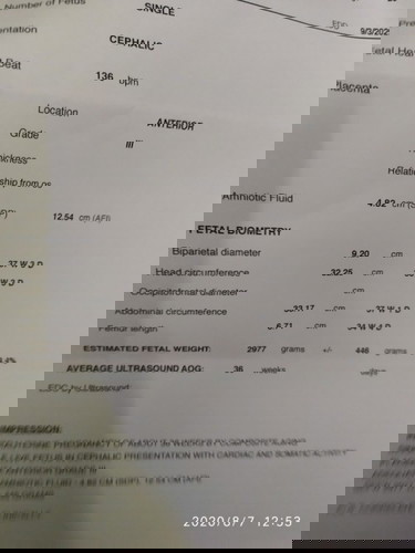 pahelp naman po sa ultrasound ko.