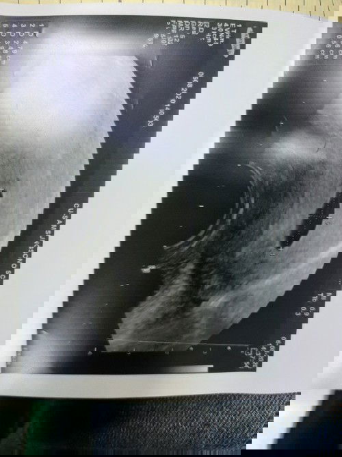 สอบถามเรื่องการฝากครรภ์