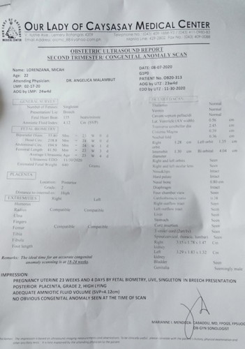 CAS Result