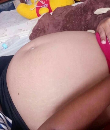 30+4 Week ท้องแข็งมาก