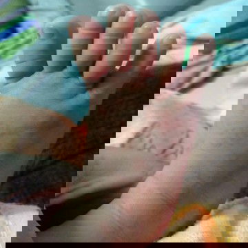 ลูกแพ้อะไร