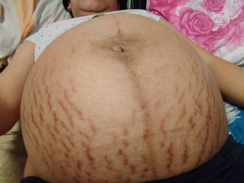 pregnant