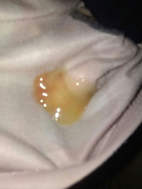 tanya tanda2 melahirkan. teman