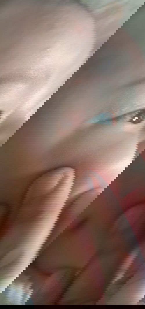 merah di pinggir mata