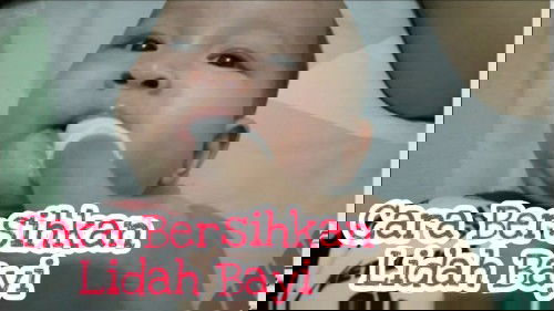 Cara Bersihkan Lidah Bayi Putih