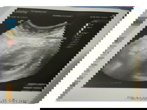 เจอกันครั้งแรก ❤