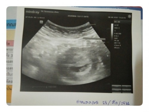 เจอกันครั้งแรก ❤