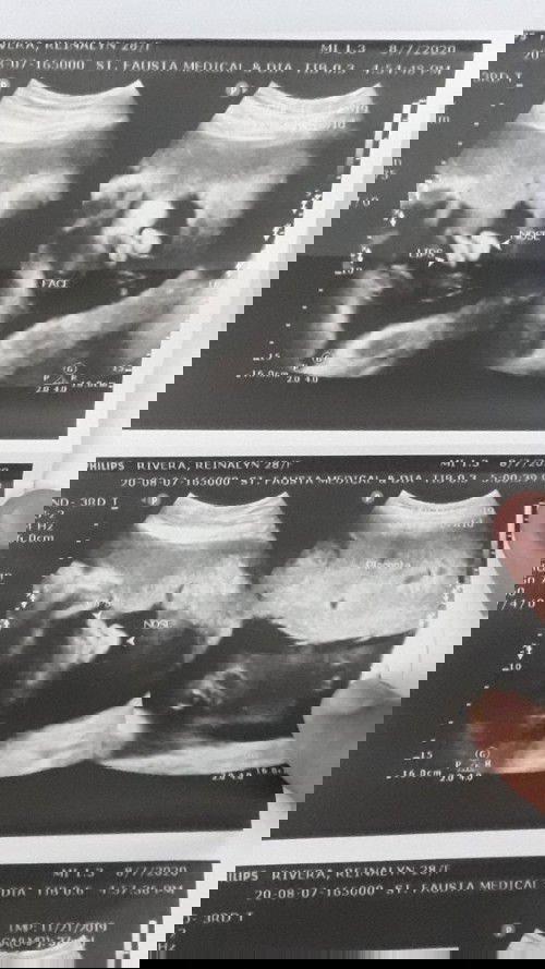 37weeks and 2days n sia ngaun