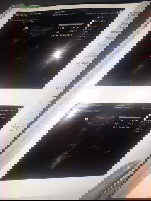 ada yg paham dgn hasil usg ini?