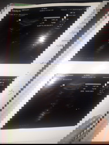 ada yg paham dgn hasil usg ini?