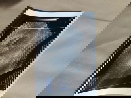 Bingung Ada sedikit pendarahan