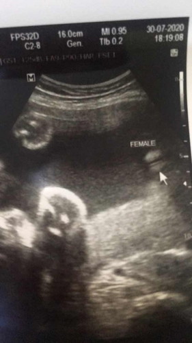 31w+1