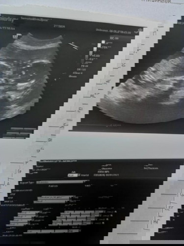 ความคิดเห็นเรื่องเพศลูก