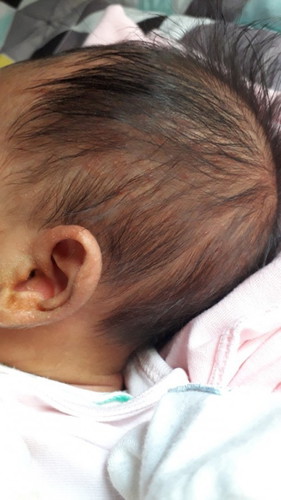 gangguan kulit pada bayi