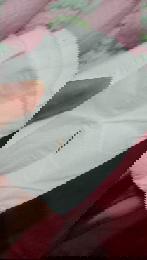 Jahitan Rontok atau lepas ya?