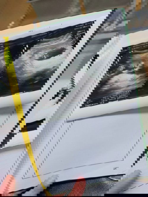 jenis kelamin calon debay