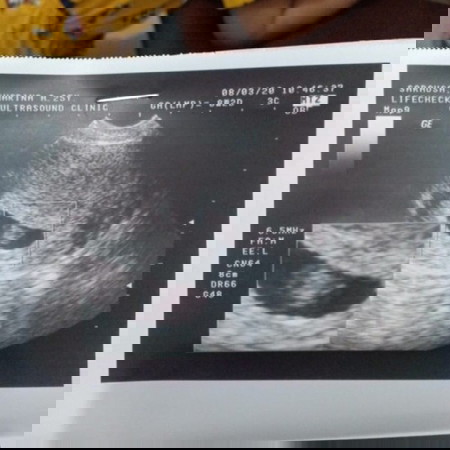 First time mommy 🥰