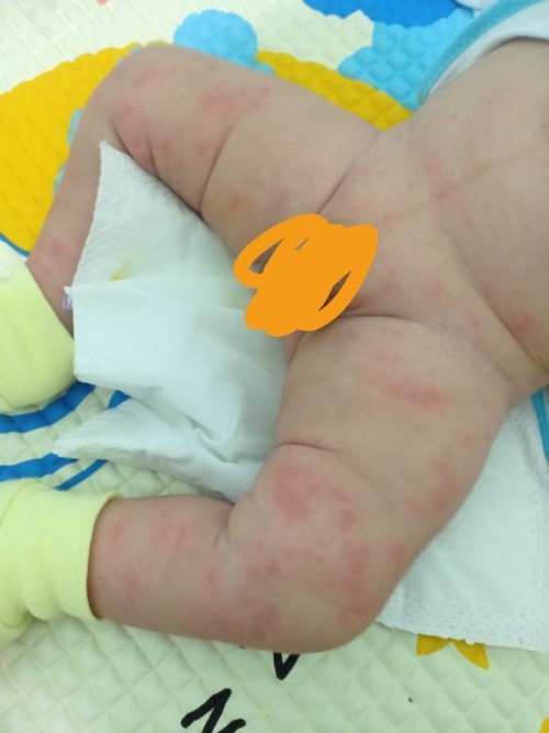 Nổi mận phần dưới