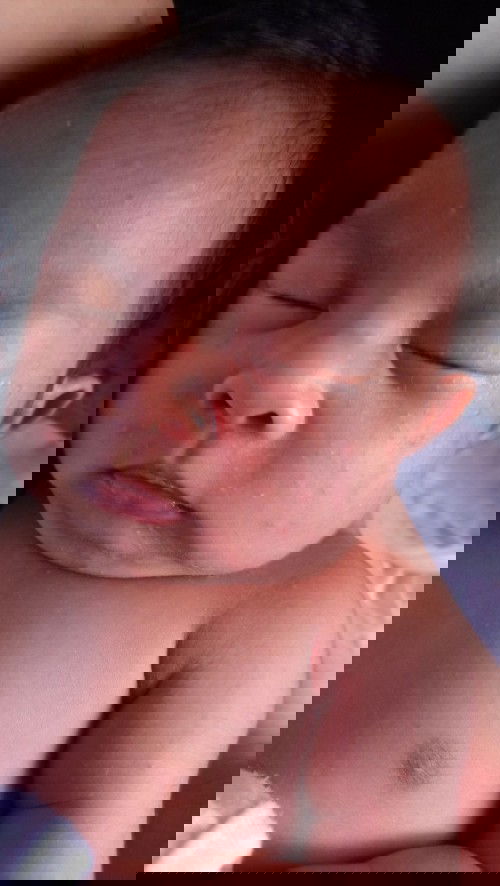 infant acne or rashes (not sure if ano talaga)