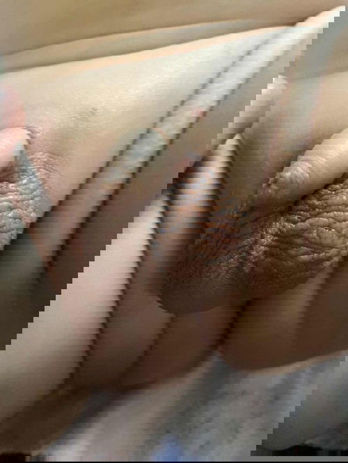 Bintik-bintik di kelamin bayi