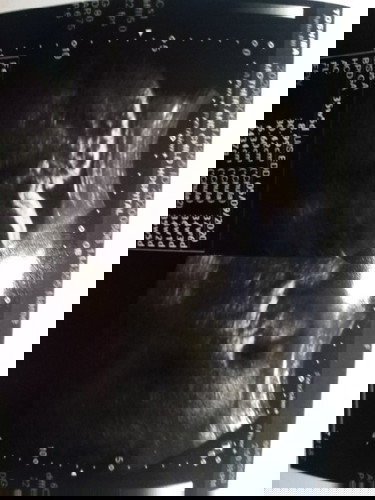 แม่อายุ20 แม่วัยใส