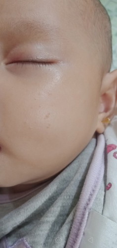 baby's face
