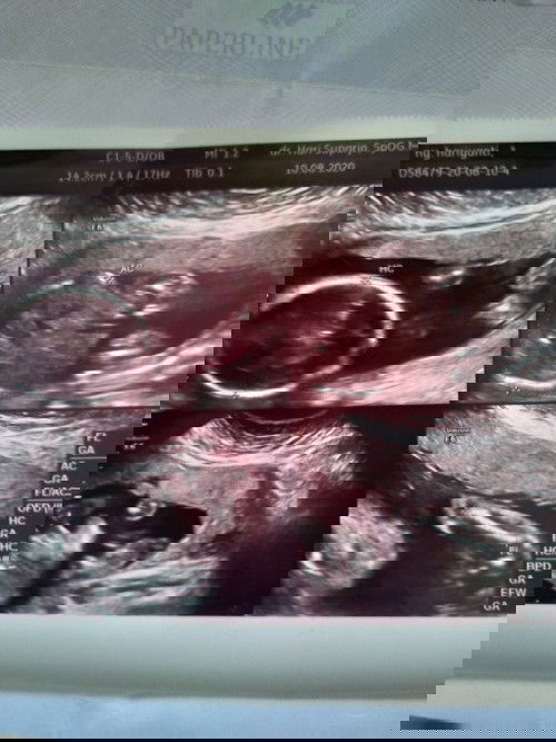 Alhamdulillah Jk baby Laki2